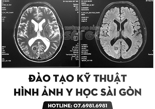 Ngành Kỹ thuật hình ảnh Y học Sài Gòn đào tạo những gì? - ảnh 1