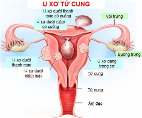 Đau bụng dưới, dấu hiệu ‘tố’ bạn mắc 1 trong 5 bệnh cực kỳ nguy hiểm - ảnh 1