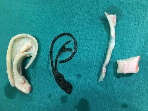Cậu bé 8 tuổi có tai mới làm từ ... sụn xương sườn - ảnh 1