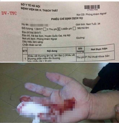 Ngành y tế nói gì vụ