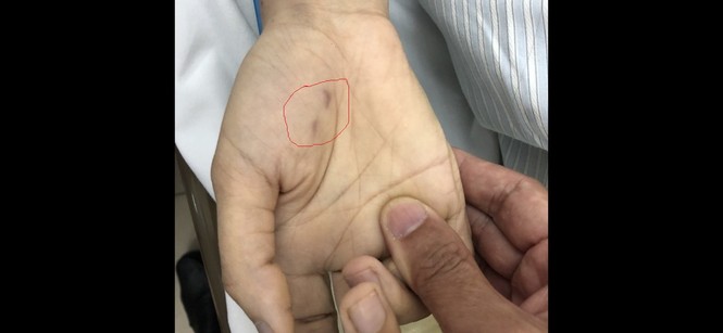 Chủ quan không tiêm phòng dại, nữ bác sỹ thú y tử vong vì chó cắn - ảnh 1