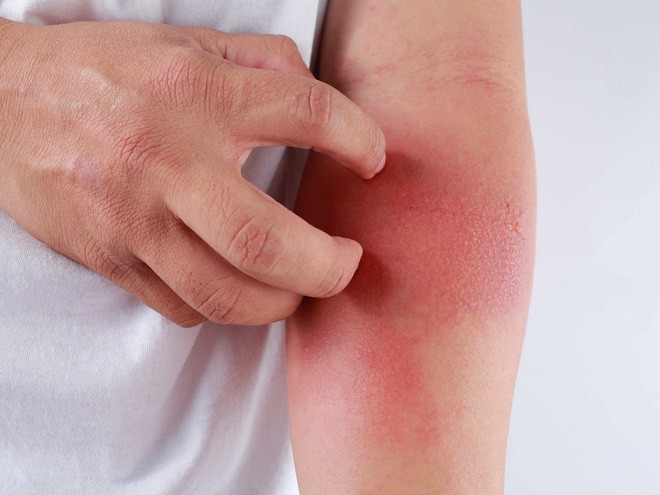 Cá diếc chữa nhiều bệnh cực tốt, nhưng 'đại kỵ' với những người này - ảnh 2