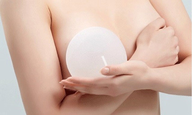 Chị em nên biết sự thật này trước khi đi 'nâng cấp vòng 1' - ảnh 1