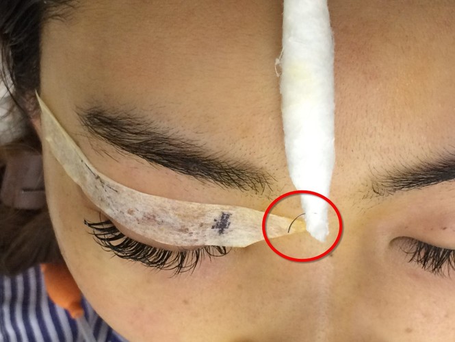Quý bà gặp 'tai nạn' khi làm đẹp khiến bác sỹ khiếp vía - ảnh 1