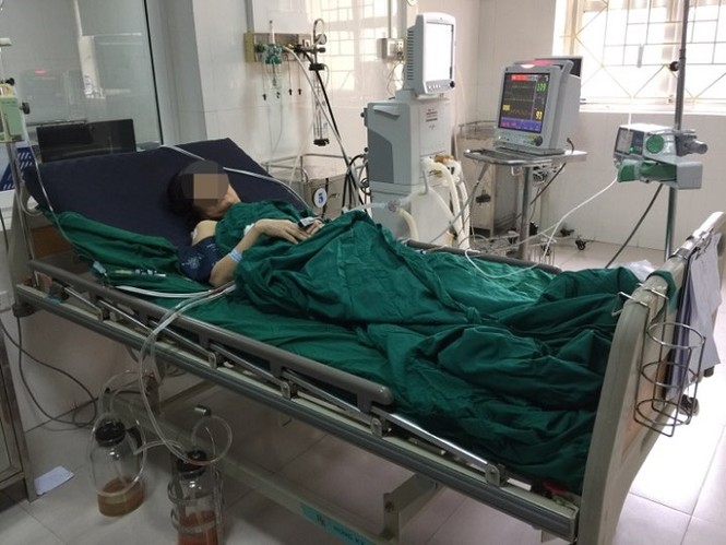 Cho phổi ngừng hoạt động 80 phút để 'bóc' khối u khủng - ảnh 1
