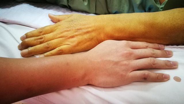 Có những dấu hiệu này, đi khám gan ngay kẻo muộn - ảnh 2