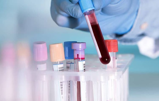 Cứ xét nghiệm máu là biết có nhiễm HIV hay không? - ảnh 2 Cứ xét nghiệm máu là biết có nhiễm HIV hay không? - ảnh 2