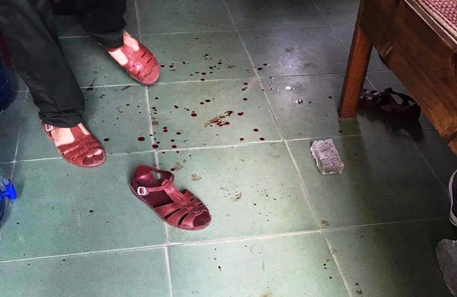 Ngang nhiên xông vào cơ quan làm việc hành hung nhân viên bảo vệ rừng - ảnh 1