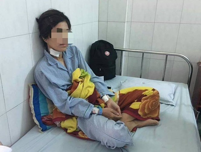 Chồng cũ cắt tai, bạo hành vợ ở Quảng Nam - ảnh 1
