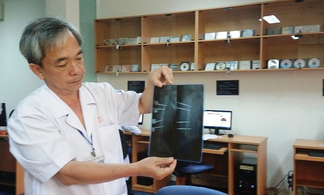 Cứu bệnh nhi người Campuchia 14 ngày không thể đi tiểu - ảnh 1
