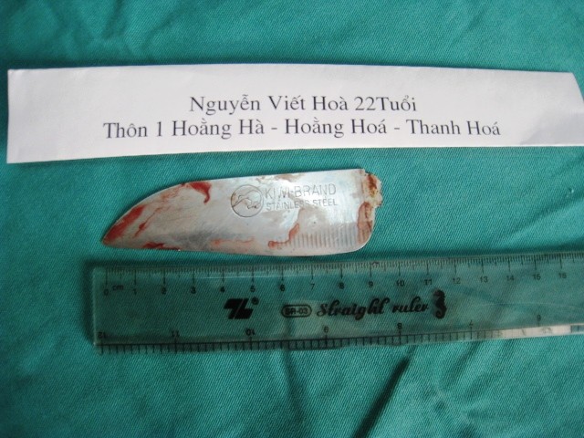 Cứu sống nạn nhân bị đâm thủng phổi - ảnh 1