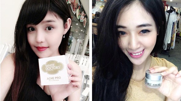 Cách 'thổi bay' các loại mụn trứng cá - ảnh 3