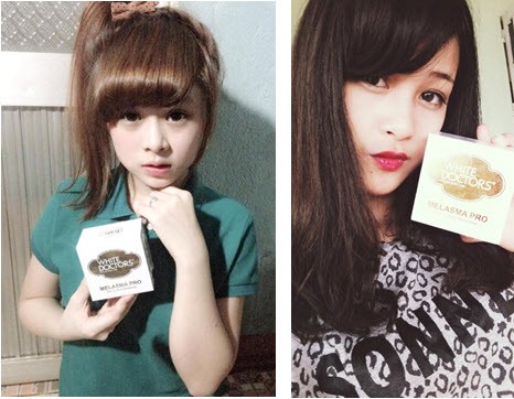 Cách trị hết nám hoàn toàn, ngăn nám không trở lại - ảnh 5