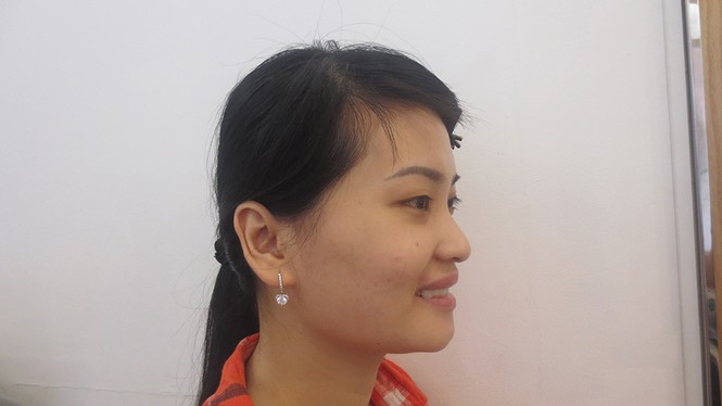 Đẹp ngỡ ngàng sau khi được bác sĩ Bệnh viện JW thẩm mỹ - ảnh 2