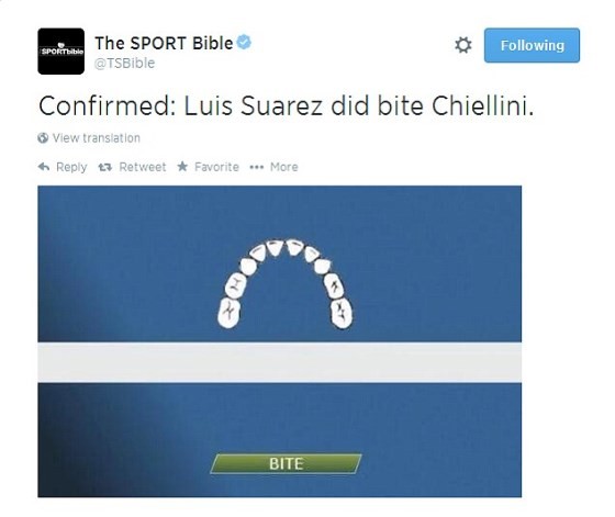 Sau cắn người, Suarez 'đóng phim'... Hàm cá mập - ảnh 4