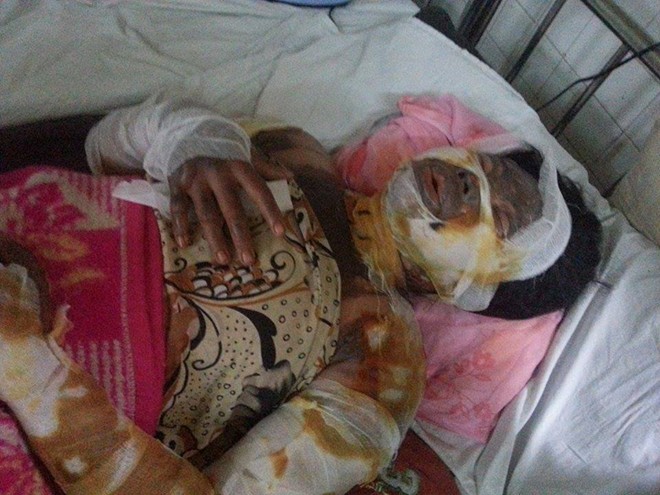 Nghi án cha dượng thiêu sống con riêng của vợ vì bị chối yêu - ảnh 1