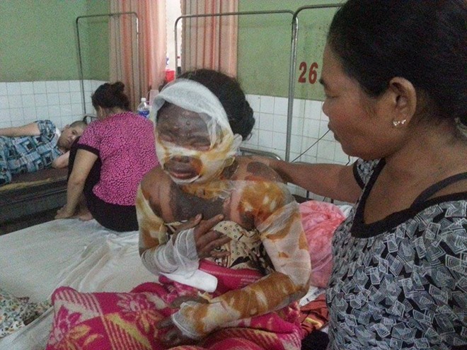 Nghi án cha dượng thiêu sống con riêng của vợ vì bị chối yêu - ảnh 2