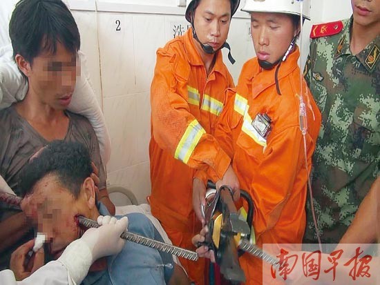 Sống sót sau khi bị thanh sắt đâm xuyên đầu - ảnh 1