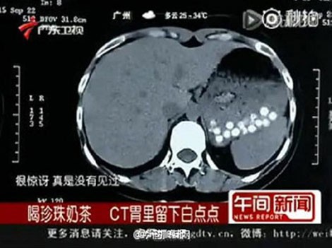 Hãi hùng trà sữa trân châu làm từ đế giày và bỉm trẻ em - ảnh 1