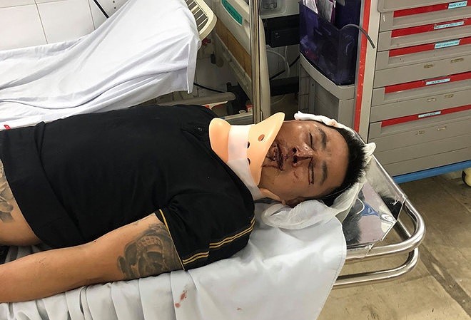 'Xẻ' đất công phân lô bán nền, công an đề nghị dân không ở cao cốc nghìn tỷ - ảnh 3