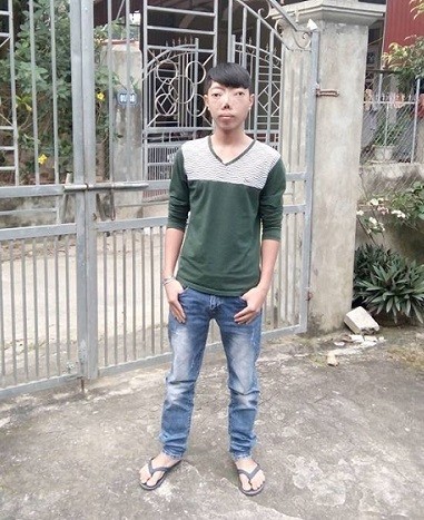 Hành trình 8 năm tìm lại cuộc đời của cậu bé 'không có mặt' - ảnh 10