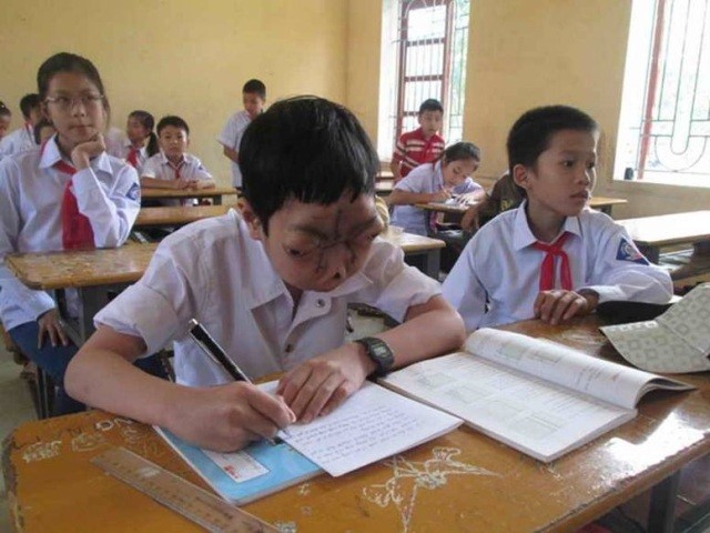 Hành trình 8 năm tìm lại cuộc đời của cậu bé 'không có mặt' - ảnh 4
