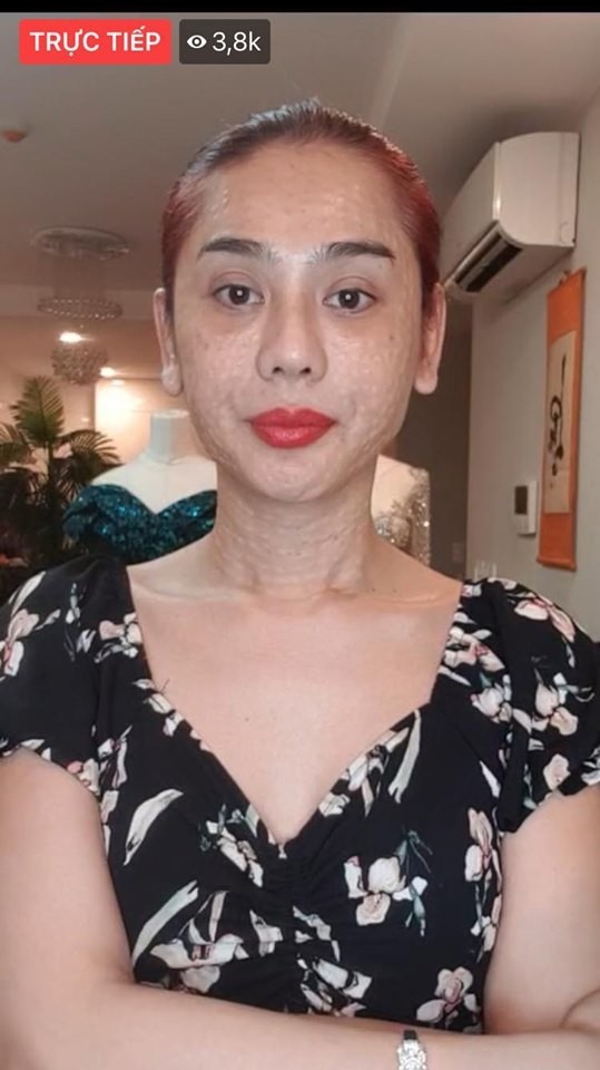 Lâm Khánh Chi gây sốc với gương mặt nhăn nheo, chi chít sần sùi - ảnh 1