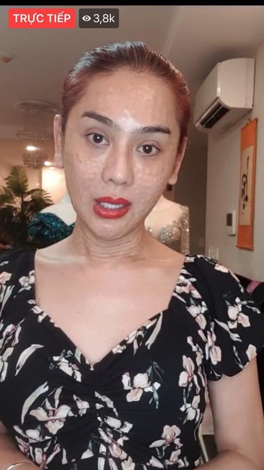 Lâm Khánh Chi gây sốc với gương mặt nhăn nheo, chi chít sần sùi - ảnh 2