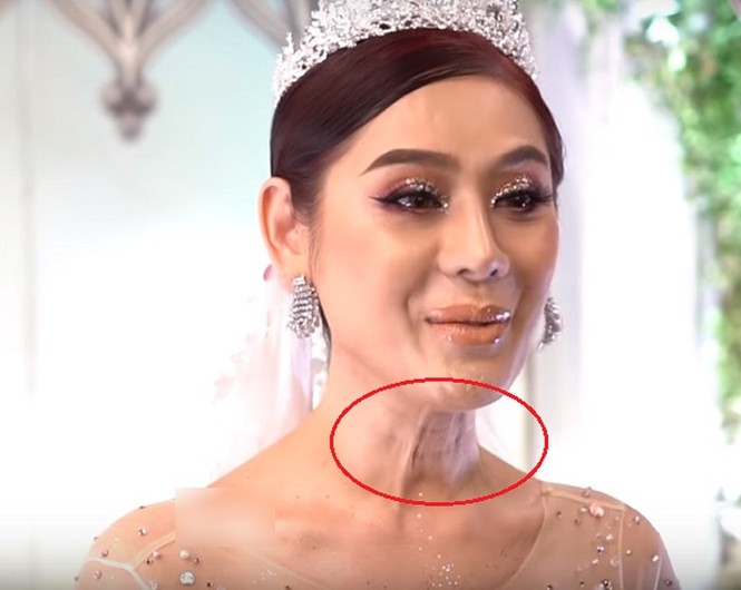 Lâm Khánh Chi gây sốc với gương mặt nhăn nheo, chi chít sần sùi - ảnh 3
