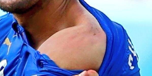 Hãi hùng với pha cắn người của 'hung thần' Suarez - ảnh 6