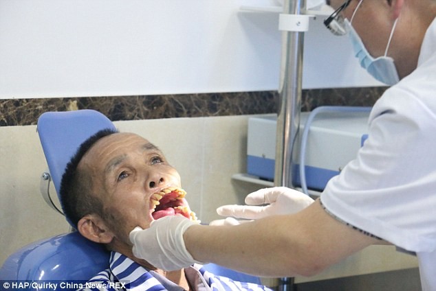 Mang hàm răng kỳ quái vì bị sói tấn công - ảnh 1