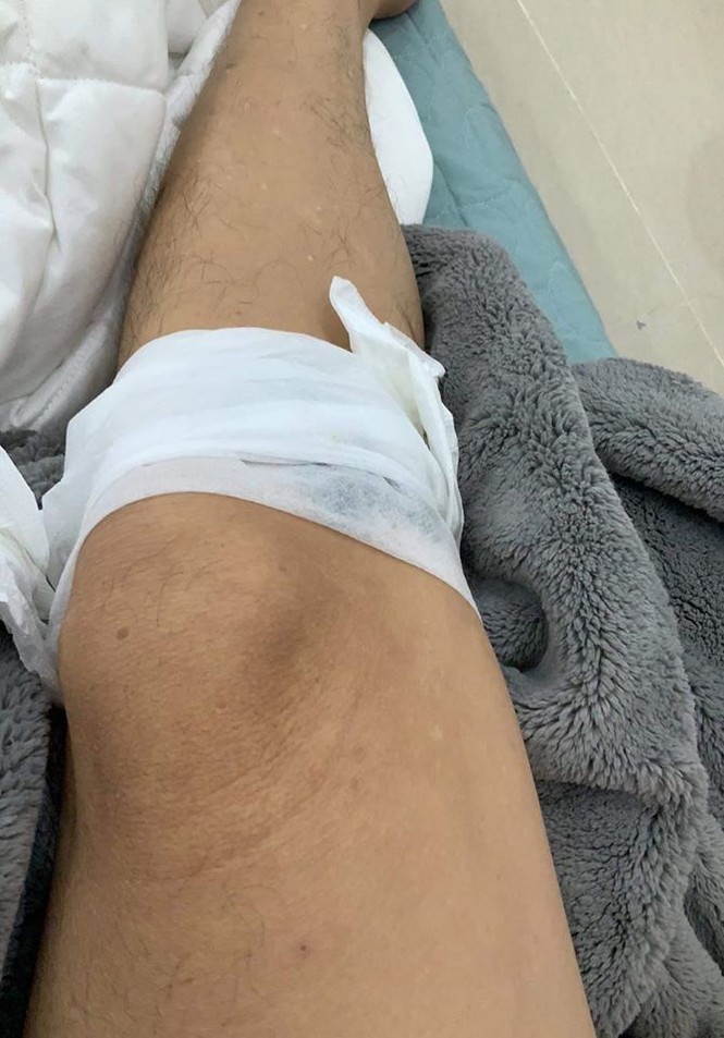 Showbiz 2/7: Hoài Linh bị gà đá chảy máu chân, Thanh Hằng khoe vòng eo 51cm - ảnh 1