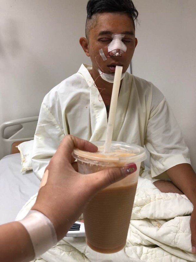 Hình ảnh sau phẫu thuật thẩm mỹ của Lương Bằng Quang gây bất ngờ - ảnh 3
