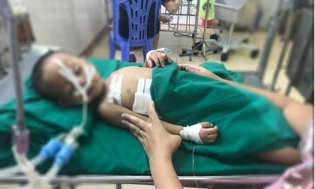 Bé 19 tháng tuổi bị đạn súng hơi găm vào ngực - ảnh 1