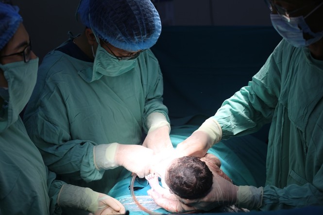 Bé trai chào đời cùng khối u xơ lớn của mẹ sau 18 năm chờ đợi - ảnh 1
