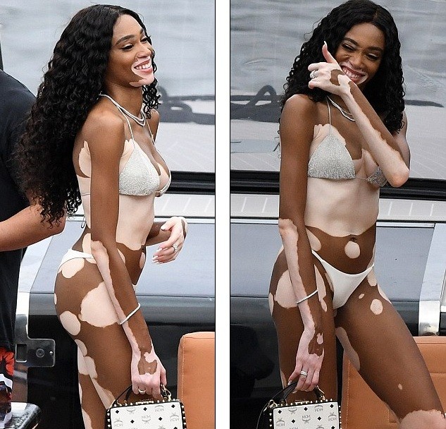 Siêu mẫu Winnie Harlow diện bikini nhảy múa trên du thuyền triệu đô - ảnh 8