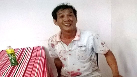 Giành làm đại ca giang hồ, một thanh niên bị đâm gục - ảnh 1