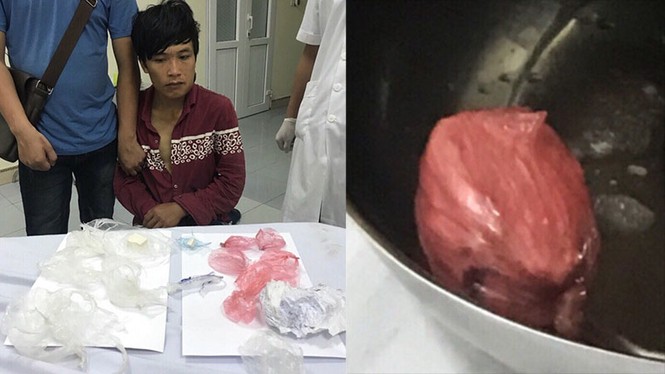 12 giờ 'giải cứu' khối ma túy khủng giấu trong vùng kín - ảnh 1
