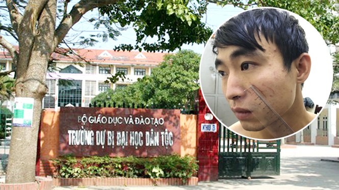 Hé lộ nguyên nhân nữ sinh 19 tuổi bị người yêu giết trong nhà nghỉ - ảnh 1
