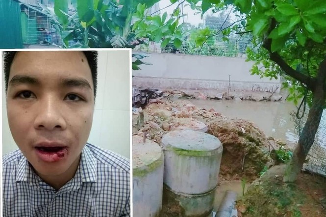 Khởi tố thầy giáo nép tuýp sắt vào mặt hàng xóm làm gãy 5 răng - ảnh 1