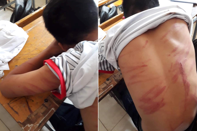 Người bố khai lý do đánh con bầm dập lưng phải nhập viện - ảnh 1