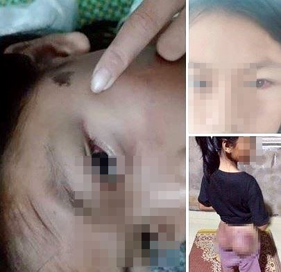 Công an viên đánh bé gái 12 tuổi bầm tím người - ảnh 1