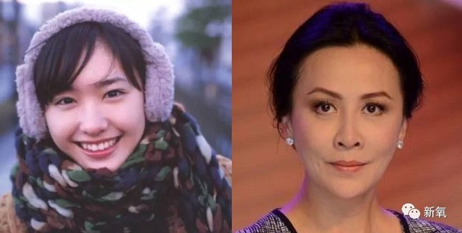 Đóng đinh vào má để có má lúm đồng tiền như diễn viên Lê Tư - ảnh 6