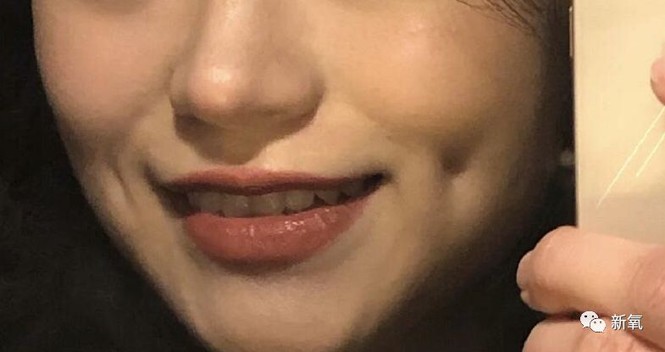 Đóng đinh vào má để có má lúm đồng tiền như diễn viên Lê Tư - ảnh 2