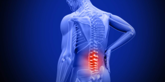 Nguyên nhân không ngờ khiến người trẻ đau lưng - ảnh 2