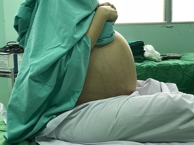 Suýt chết vì lầm tưởng khối u 18 kg là…mỡ bụng - ảnh 1