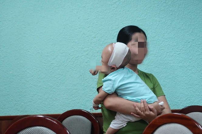 Mẹ phát hoảng vì đầu con ngày càng to do biến dạng sọ - ảnh 3