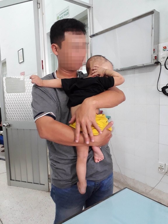 Mẹ phát hoảng vì đầu con ngày càng to do biến dạng sọ - ảnh 4