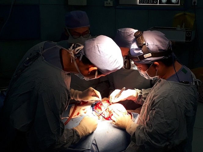 Mẹ phát hoảng vì đầu con ngày càng to do biến dạng sọ - ảnh 2