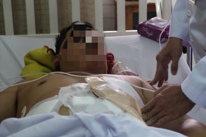 Không đòi được tiền lương,nam bảo vệ mua dao đâm đồng nghiệp suýt chết - ảnh 1